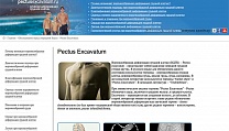 Создание сайта pectusexcavatum.ru
